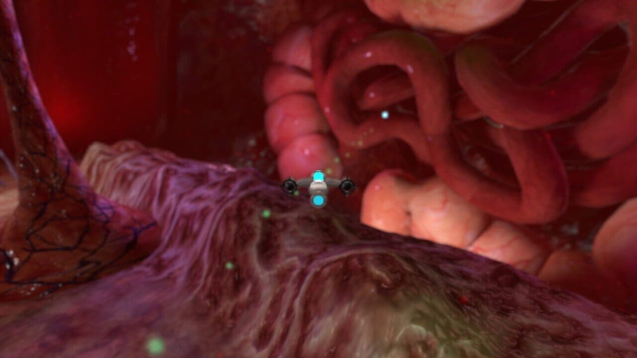 Placebo Effect thumbnail 11