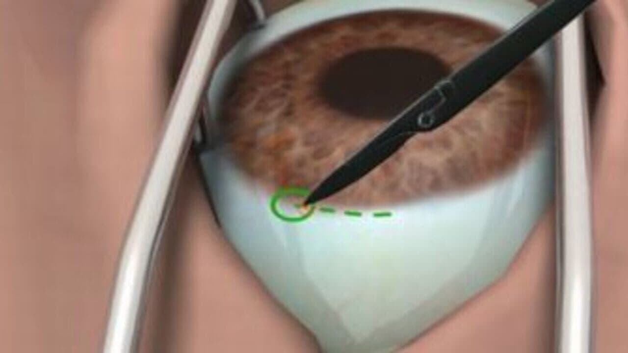 Surgery Simulator screenshot 1