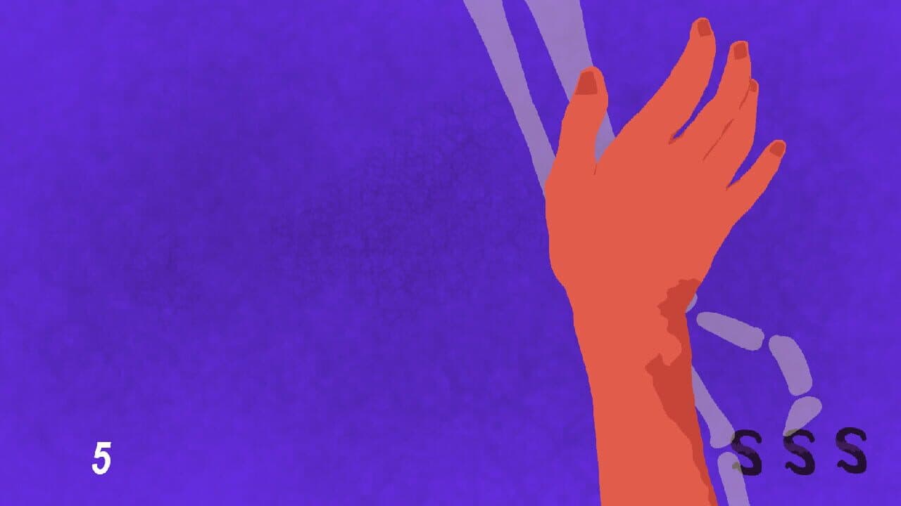 Skin Stealers thumbnail 5