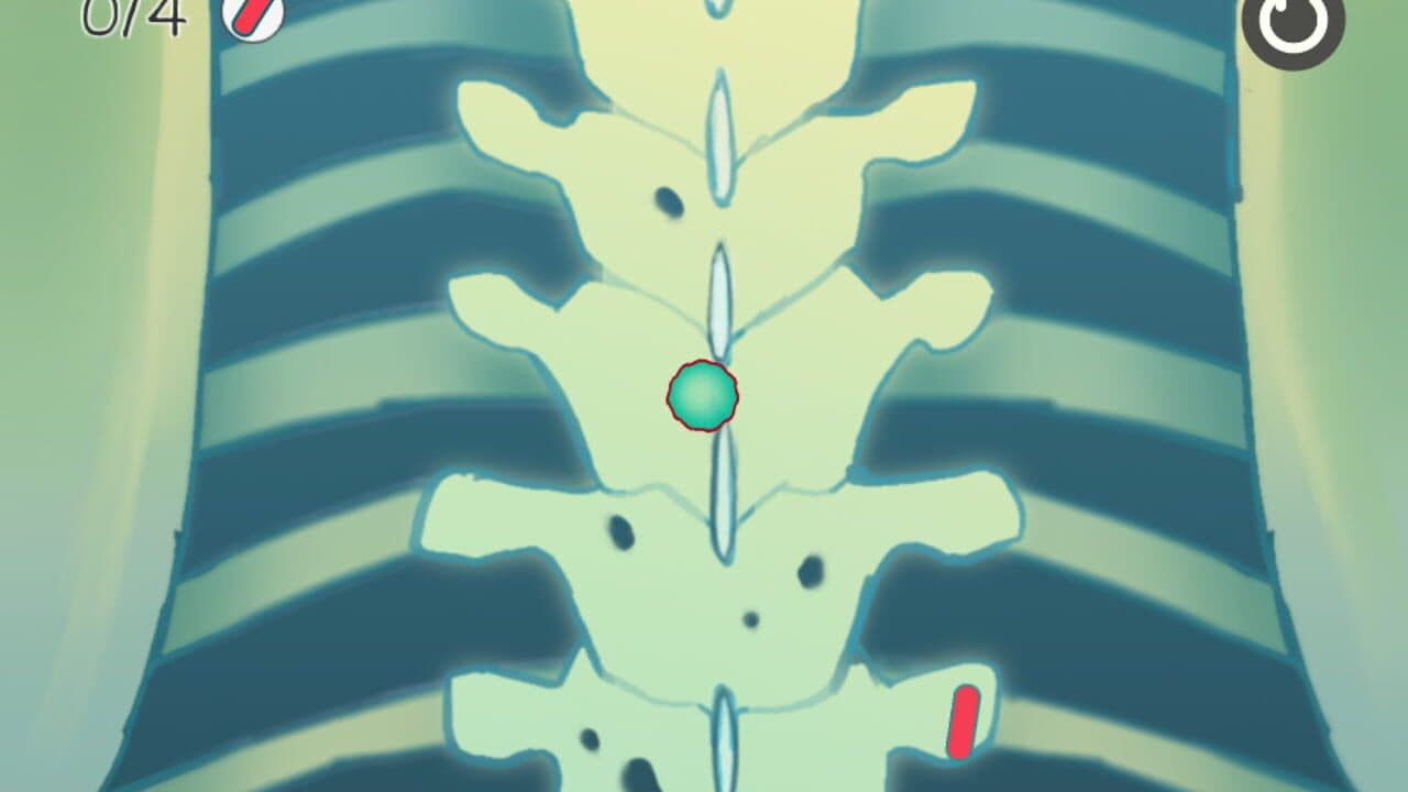 Grey Plague thumbnail 2