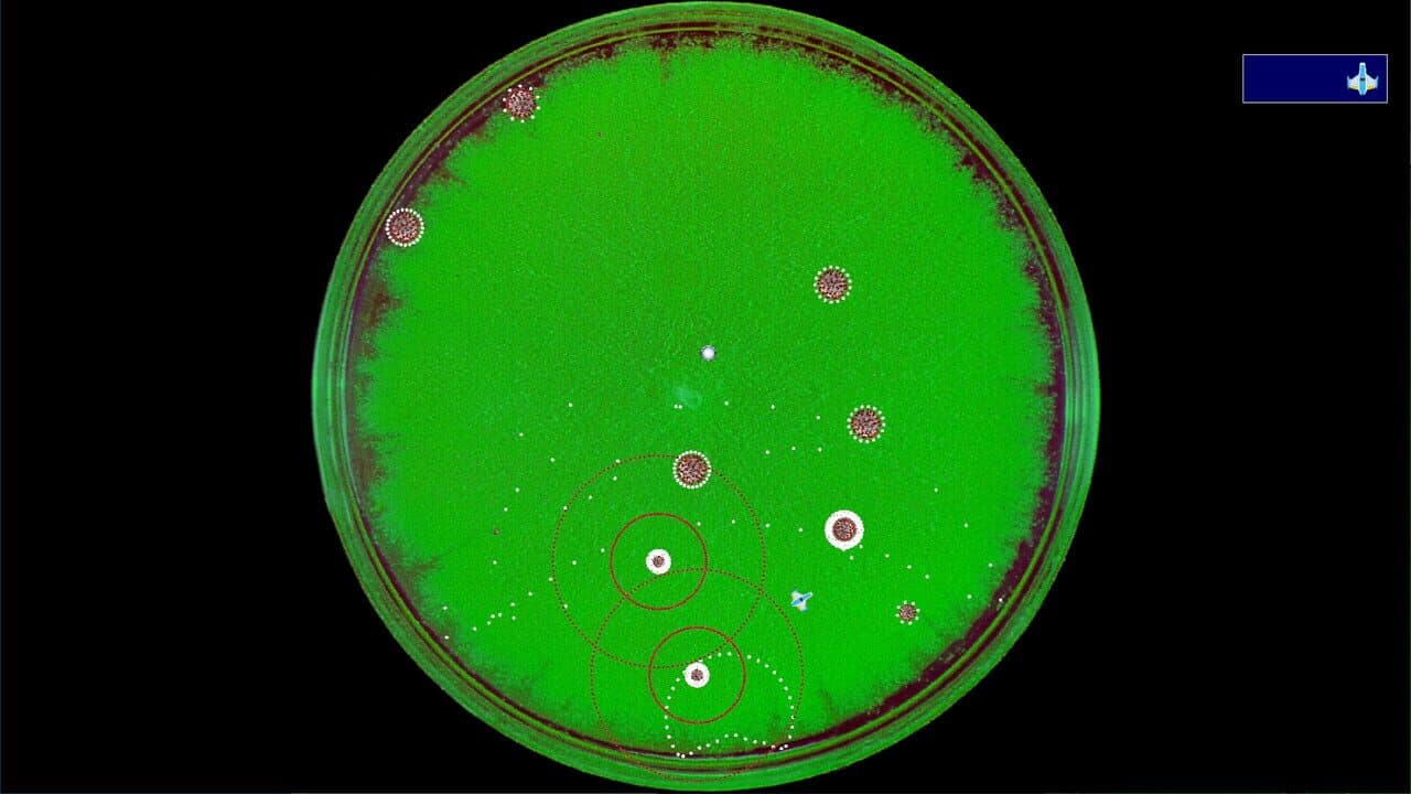 Coronavirus: Nano Force thumbnail 5