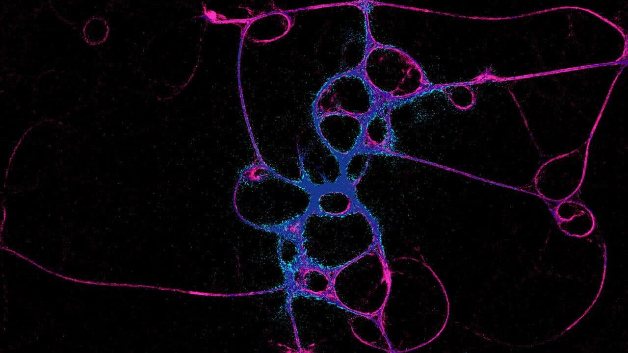 Physarum: Slime Mold Simulator thumbnail 3
