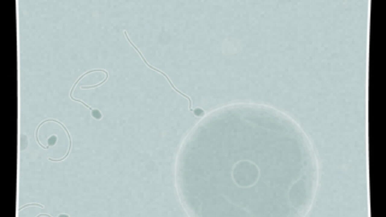 Coil thumbnail 4
