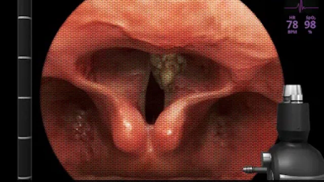 AirwayEx screenshot 1