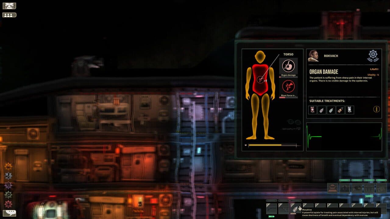 Barotrauma thumbnail 4
