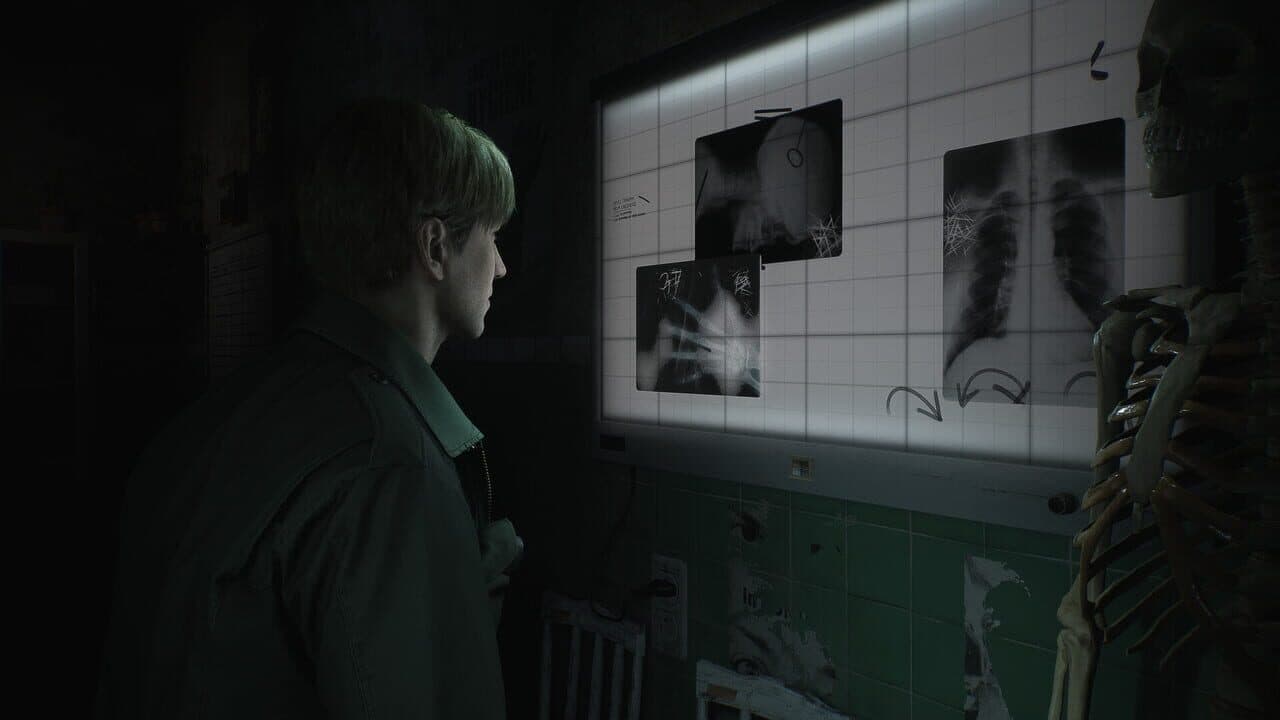Silent Hill 2 thumbnail 3