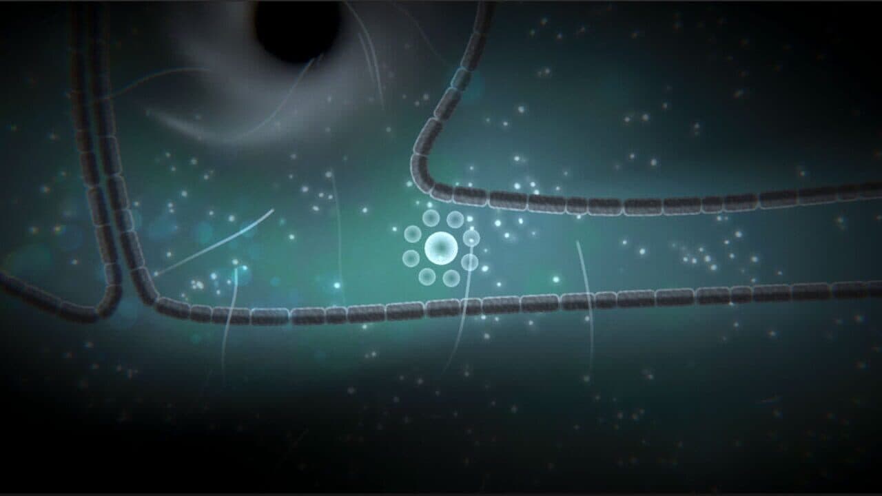 Focus Find thumbnail 4