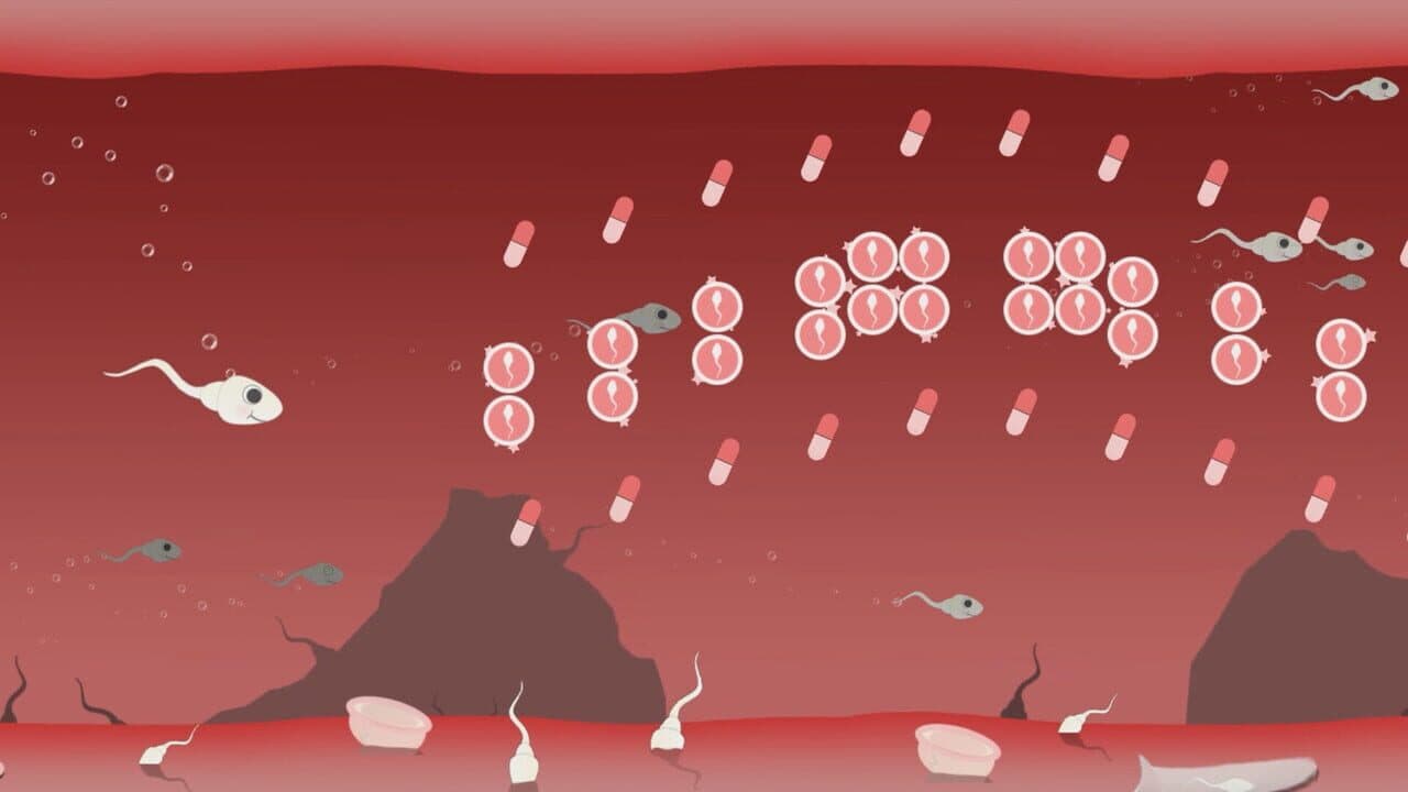 Fallopian Frenzy! Come Again? thumbnail 3