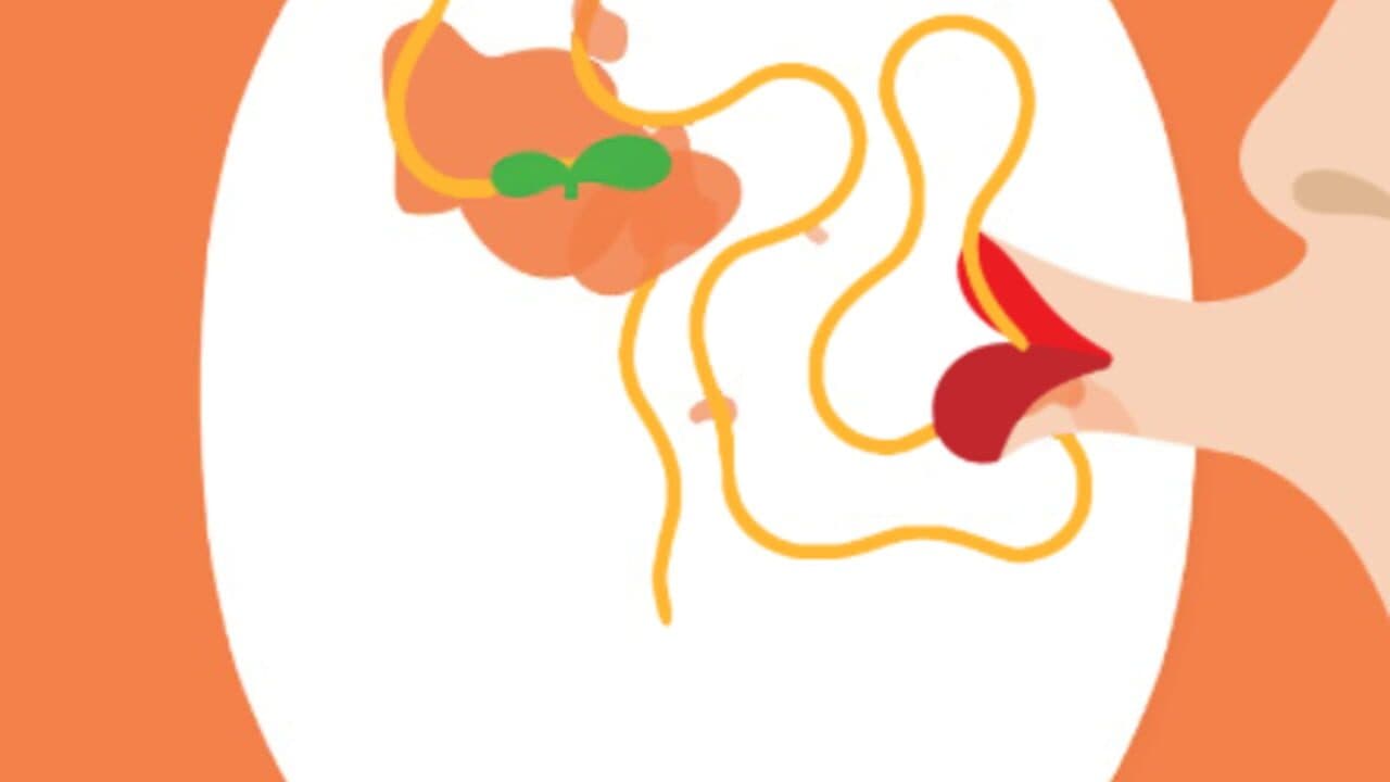 1 Meter thumbnail 2